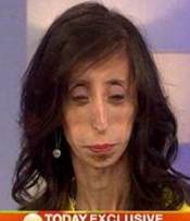 Lizzie Velasquez