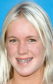 Bethany Hamilton