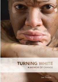 Turning White by Lee Thomas